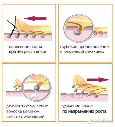 Шугаринг мужской Шугаринг мужской